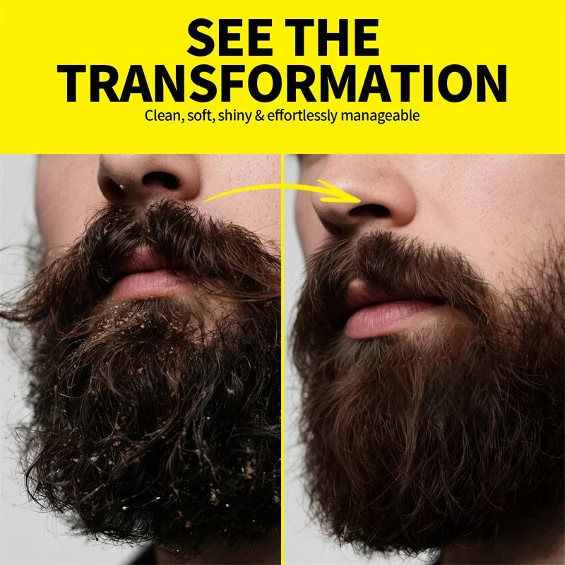 Óleo de crescimento de barba para homens hidratante natural essência de barba creme de cuidados de estilo mais grosso 30ml fortalecer a barba essencial