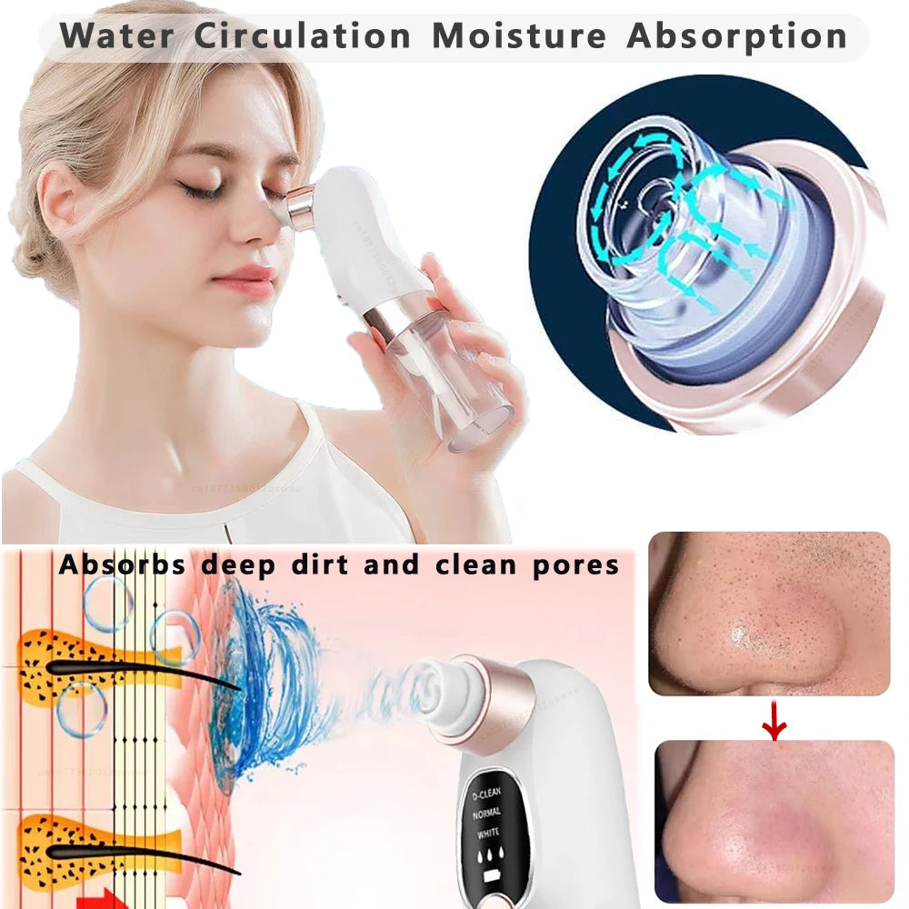 Removedor de cravo poros aspirador facial elétrico espinha acne remoção cabeça preta usb recarregável ciclo água ponto preto remover